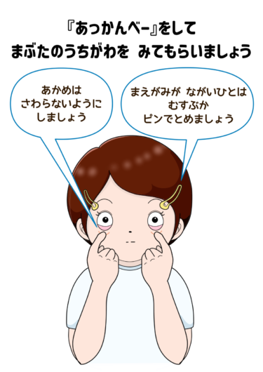 【眼科検診 掲示物】あっかんべーをしましょう(カラー)(文字あり・ひらがなver.)