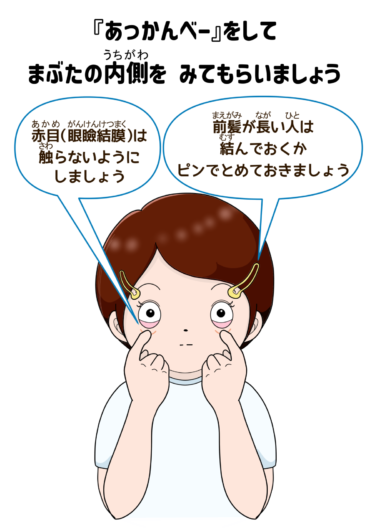 【眼科検診 掲示物】あっかんべーをしましょう(カラー)(文字あり・漢字とルビver.)